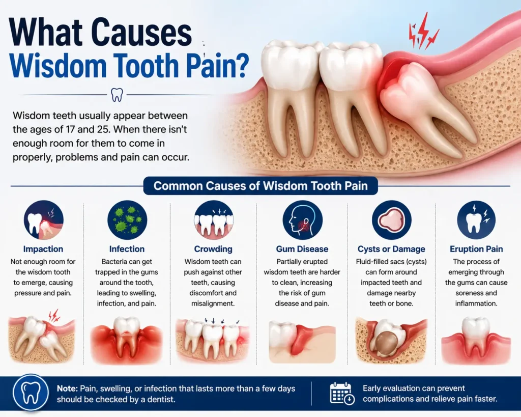 What Causes Wisdom Tooth Pain