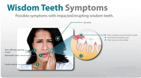 Wisdom Teeth Pain