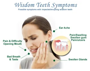 Read more about the article Why Your Wisdom Teeth Are Destroying Your Gums
