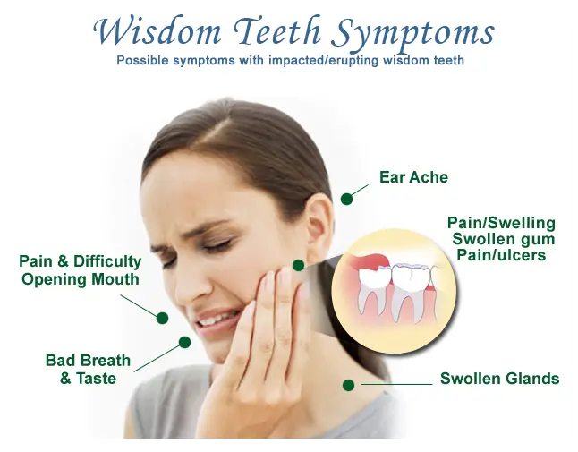 Wisdom Teeth Are
