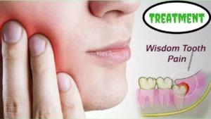 Wisdom Teeth Pain