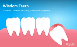 Wisdom Teeth Pain