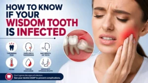 Read more about the article How to Know If Your Wisdom Tooth Is Infected: 10 Warning Signs to Watch For