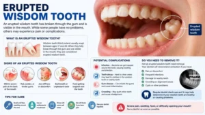 Read more about the article Erupted Wisdom Tooth: Signs, Symptoms & Relief Tips
