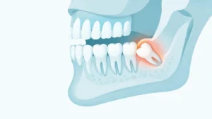 Wisdom Molar Pain: Causes, Relief & When to See a Dentist